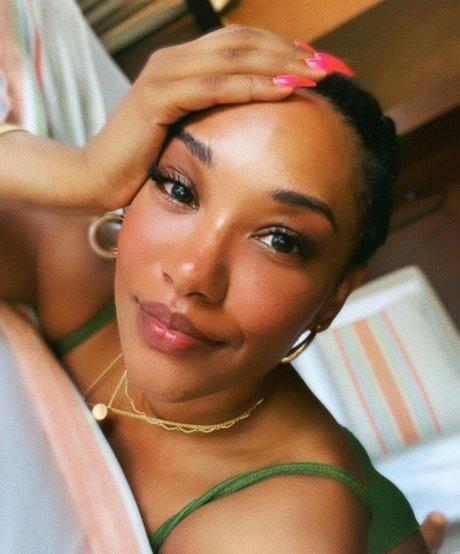Candice Patton