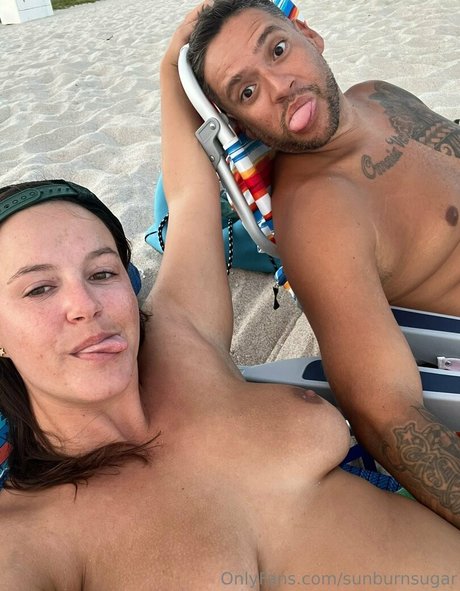Sunburnsugar