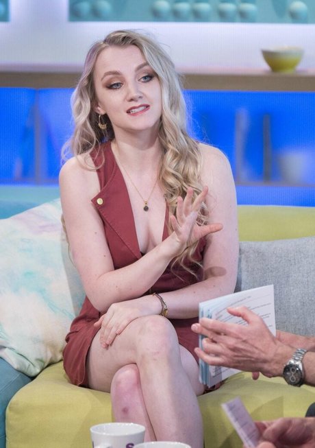 Evanna Lynch