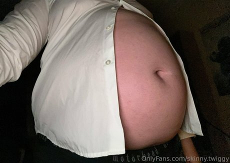 Skinnytwiggy